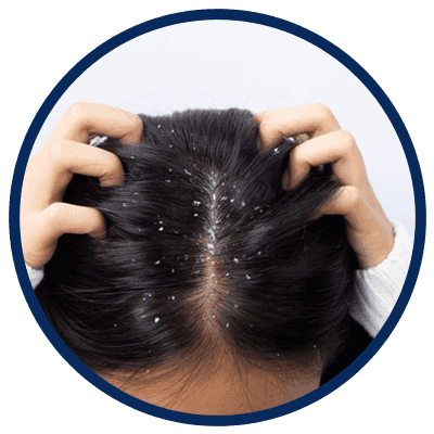 Dandruff round