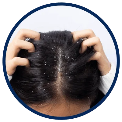 Dandruff round