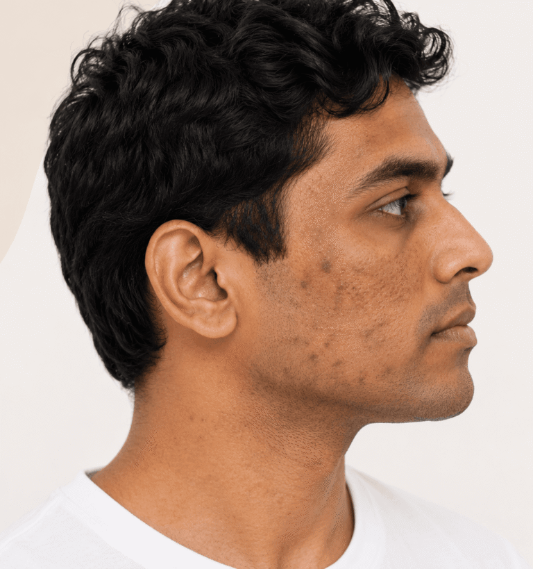 Pigmentation final
